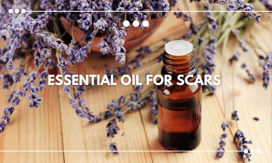 Essential Oil for Scars BALM Aromatherapy